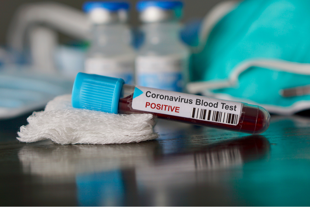 Novo coronavírus: o que precisamos saber?
